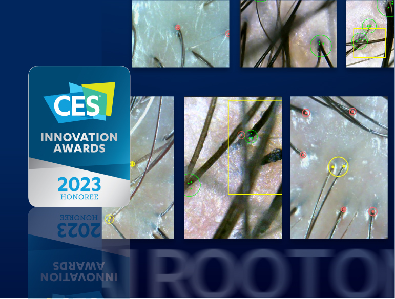 ROOTONIX won 2023 CES Innovation Awards with Volume Booster and Scalp AI Solution